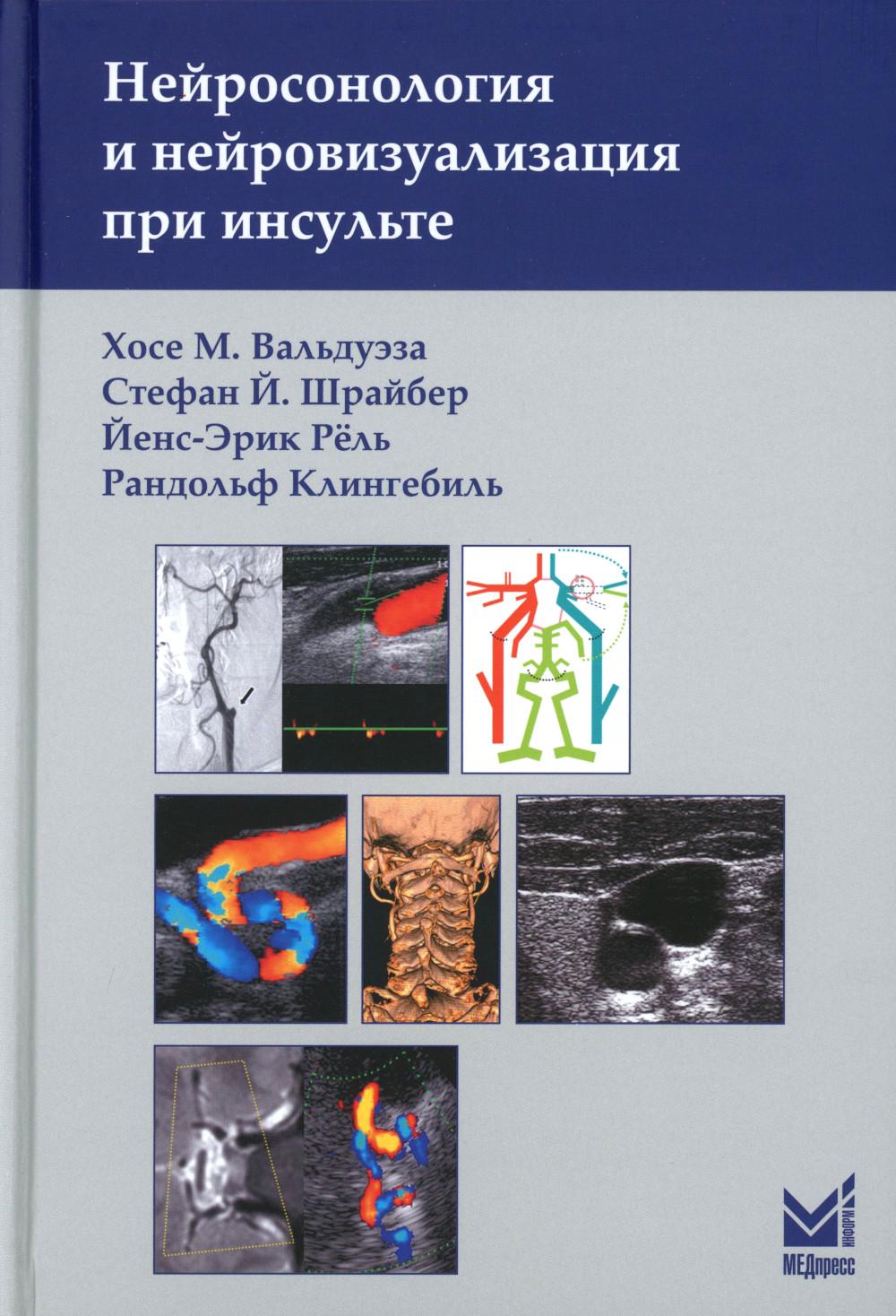 Нейросонология и нейровизуализация при инсульте. 3-е изд