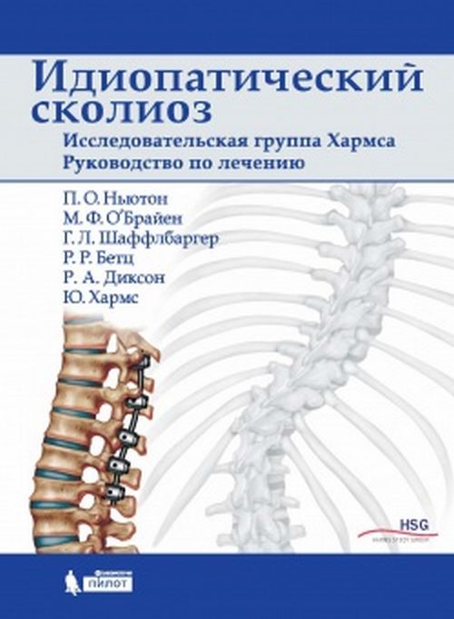 Идиопатический сколиоз. Исследовательская группа Хармса. Руководство по лечению. Ньютон П.О.