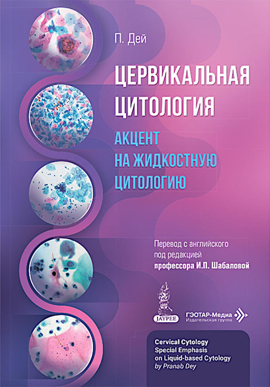 Цервикальная цитология. Акцент на жидкостную цитологию