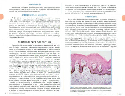 Интерпретация биопсий кожи. Первичные нелимфоидные опухоли кожи