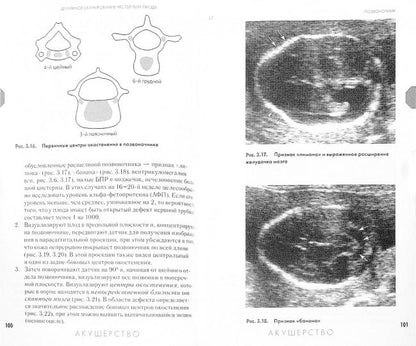 Ультразвуковая диагностика в акушерстве и гинекологии понятным языком. Смит Н.Ч., под ред. Гуса А.И.