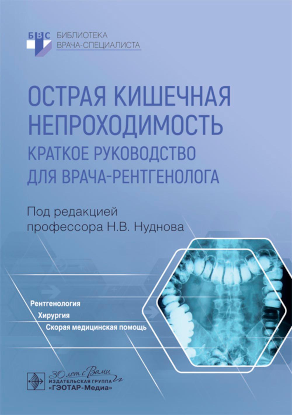 Острая кишечная непроходимость. Краткое руководство для врача-рентгенолога / под ред. Н. В. Нуднова. — Москва : ГЭОТАР-Медиа, 2024. — 88 с. : ил. — (Серия «Библиотека врача-специалиста»).