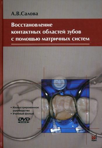 Восстановление контактных областей зубов с помощью матричных систем. 2-е изд., + CD