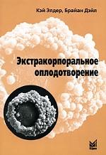 Экстракорпоральное оплодотворение