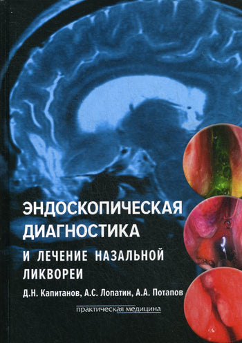 Эндоскопическая диагностика и лечение назальной ликвореи. Капитанов Д.Н., Лопатин А.С., Потапов А.А.