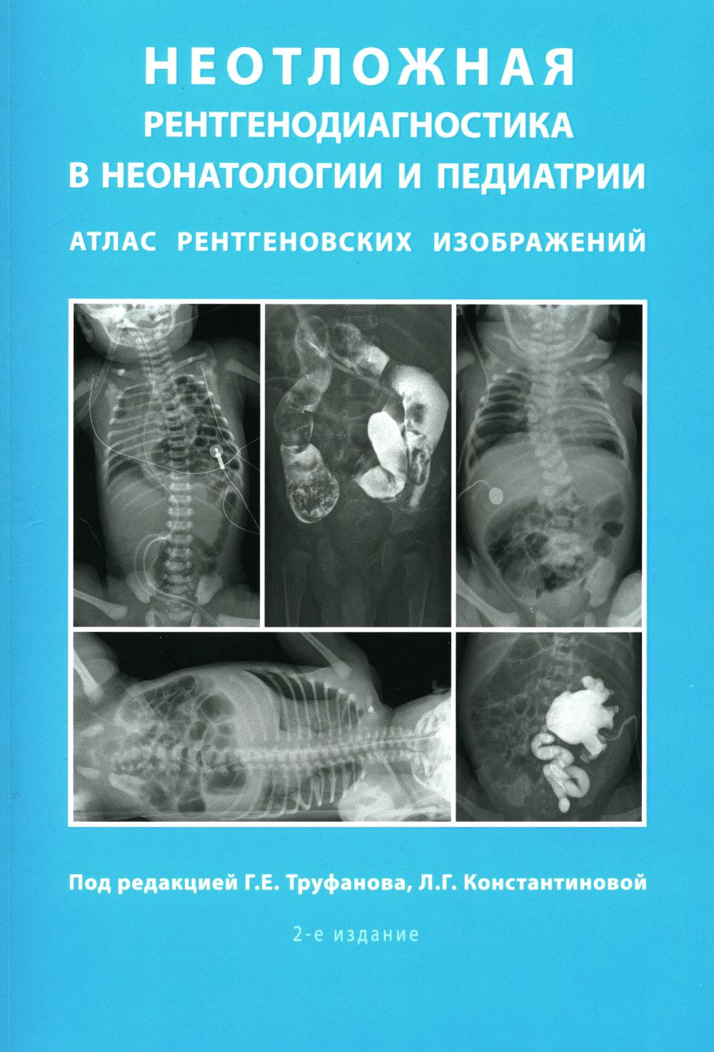 Неотложная рентгенодиагностика в неонатологии и педиатрии (Атлас рентгеновских изображений): Учебное пособие. 2-е изд., доп. и перераб