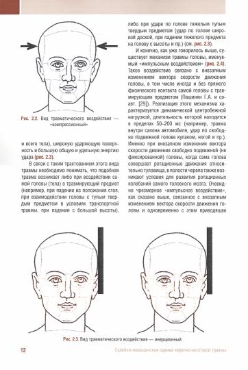 Судебно-медицинская оценка черепно-мозговой травмы: Учебное пособие