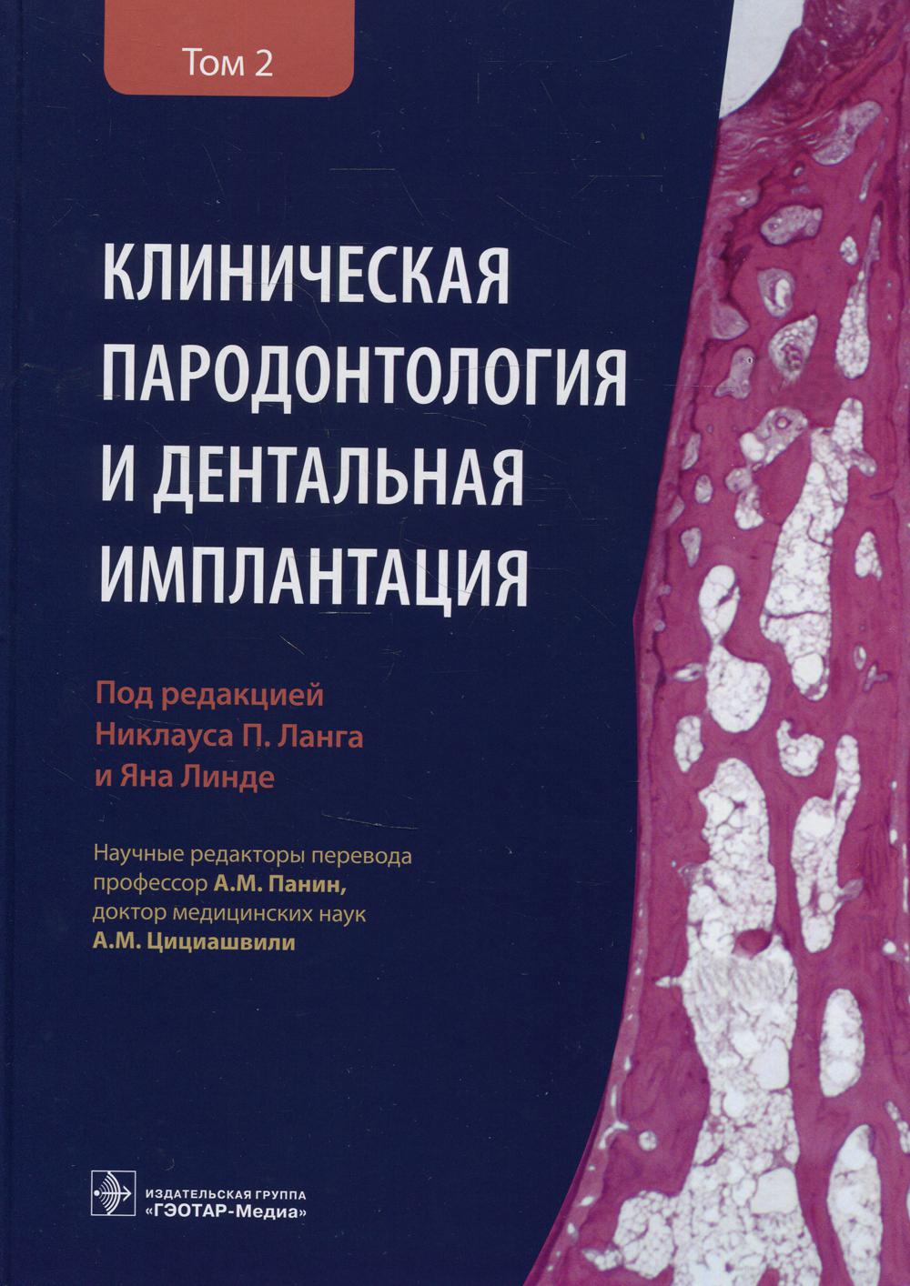 Клиническая пародонтология и дентальная имплантация : в 2 т. : Т. 2 / под ред. Н. П. Ланга, Я. Линде ; науч. ред. перевода А. М. Панин, А. М. Цициашвили. — Москва : ГЭОТАР-Медиа, 2022. — 816 с. : ил.