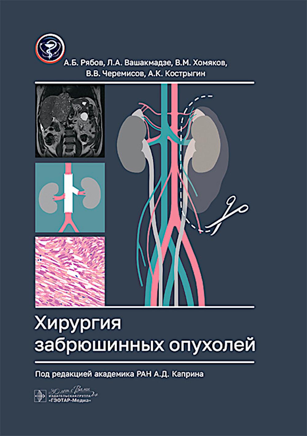 Хирургия забрюшинных опухолей / А. Б. Рябов, Л. A. Вашакмадзе, В. M. Хомяков [и др.] ; под ред. A. Д. Caprina. — Москва : ГЭОТАР-Медиа, 2025. — 216 с. : ou