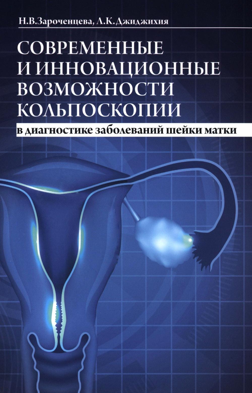 Современные и инновационные возможности кольпоскопии в диагностике заболеваний шейки матки. 2-е изд., доп.и перераб