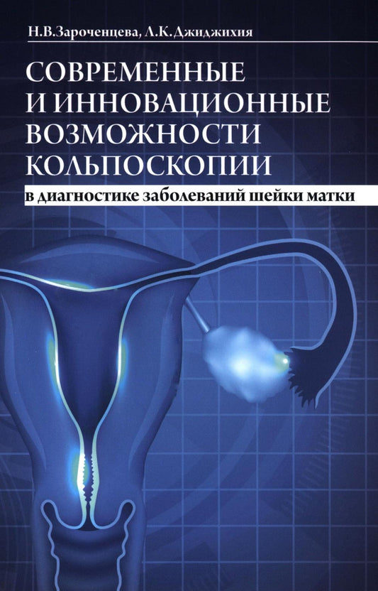 Современные и инновационные возможности кольпоскопии в диагностике заболеваний шейки матки. 2-е изд., доп.и перераб