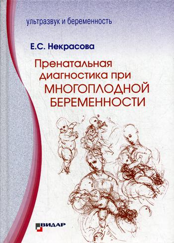 Пренатальная диагностика при многоплодной беременности (9249)