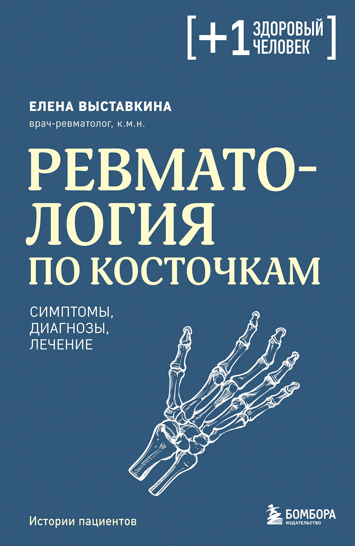 Ревматология по косточкам. Symptômes, diagnostics, symptômes
