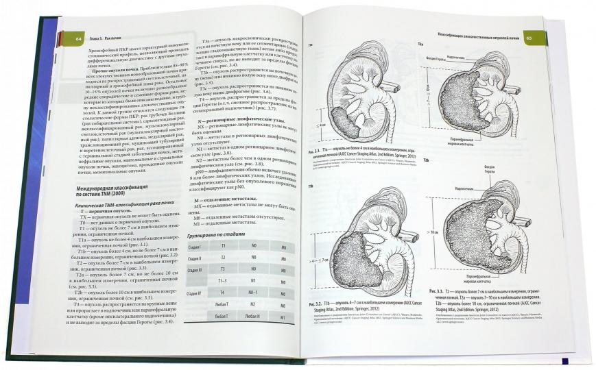 Атлас операций при злокачественных опухолях органов мочеполовой системы. Под ред. Трахтенберга А.Х., Чиссова В.И., Каприна А.Д.
