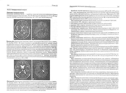 Neurologie : Учебник. Суслина З.А., Пирадов М.А., Максимова М.Ю.