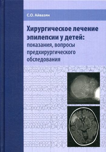 Хирургическое лечение эпилепсии у детей: показания, вопросы предхирургического обследования. Айвазян С.О.