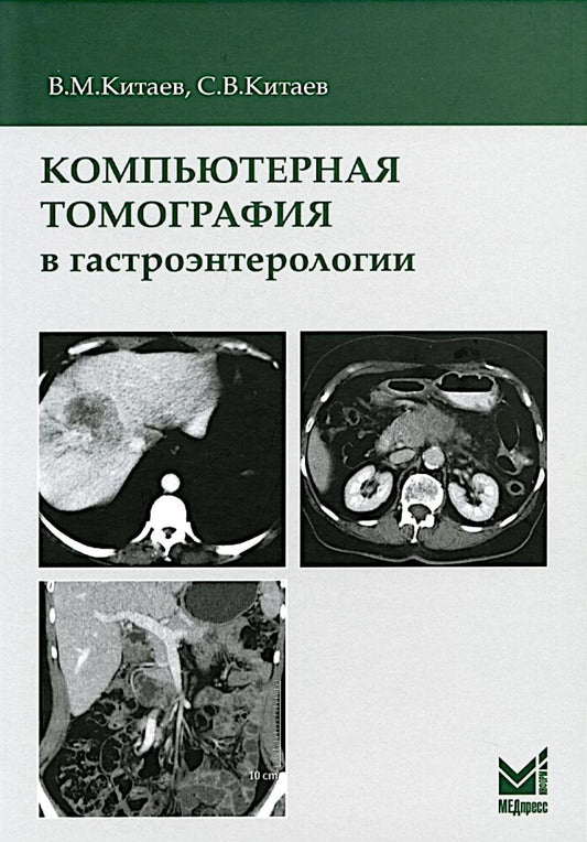 Компьютерная томография в гастроэнтерологии: руководство для врачей. 3-е изд., испр.и доп