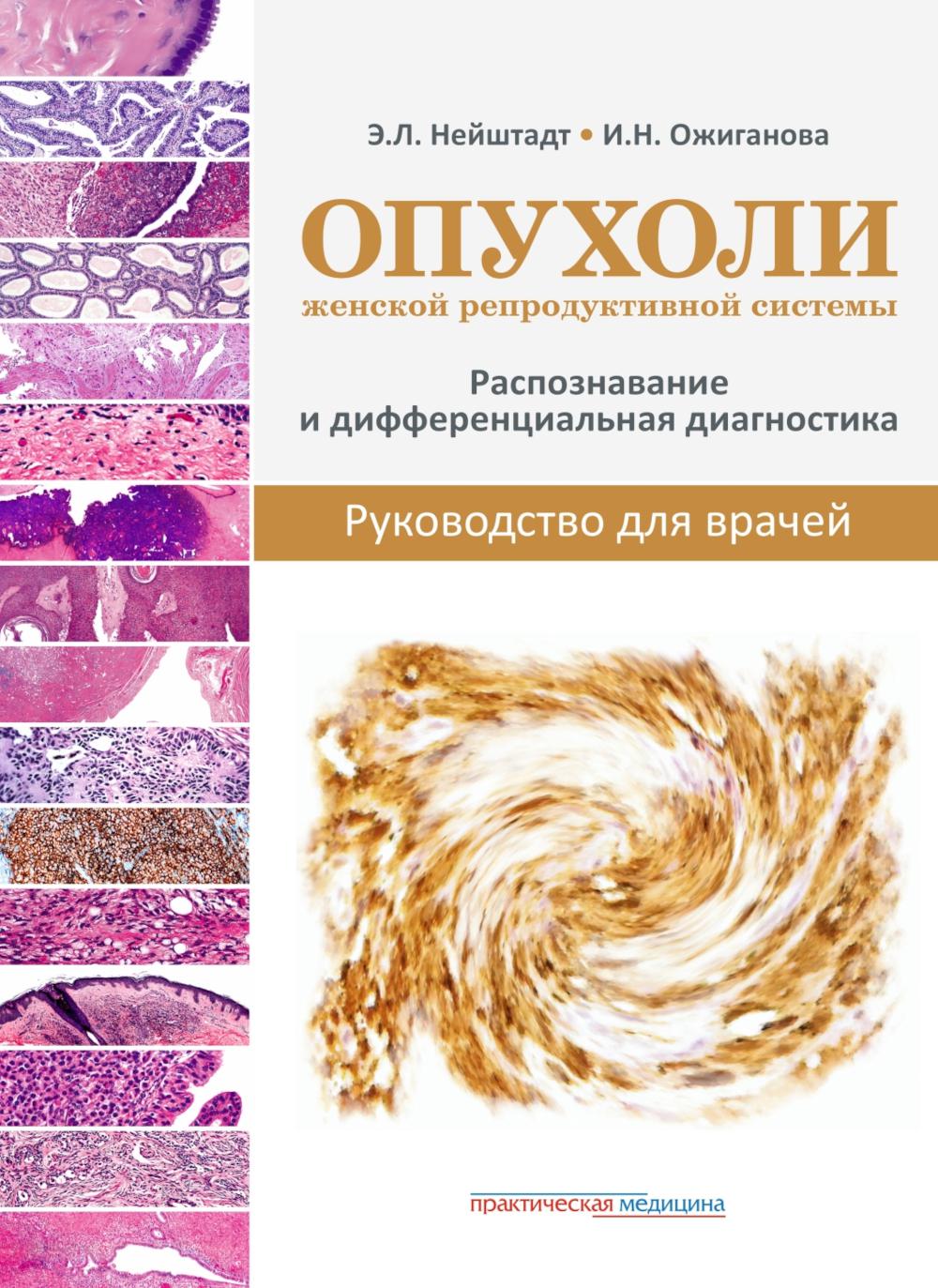 Systèmes de reproduction féminins disponibles. Diagnostic de réponse et de différentiel. Руководство для врачей***