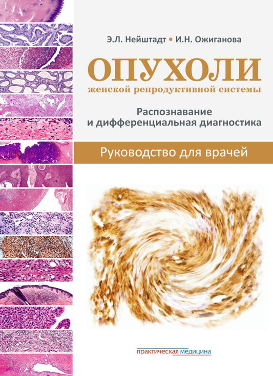 Systèmes de reproduction féminins disponibles. Diagnostic de réponse et de différentiel. Руководство для врачей***