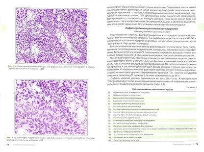 Опухоли мочевыделительной системы и мужских половых органов. Морфологическая диагностика и генетика: Руководство для врачей. 2-е изд., доп. Андреева Ю.Ю.