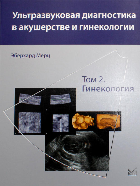 Ультразвуковая диагностика в акушерстве и гинекологии: В 2 т. Т. 2: Гинекология. 2-е изд