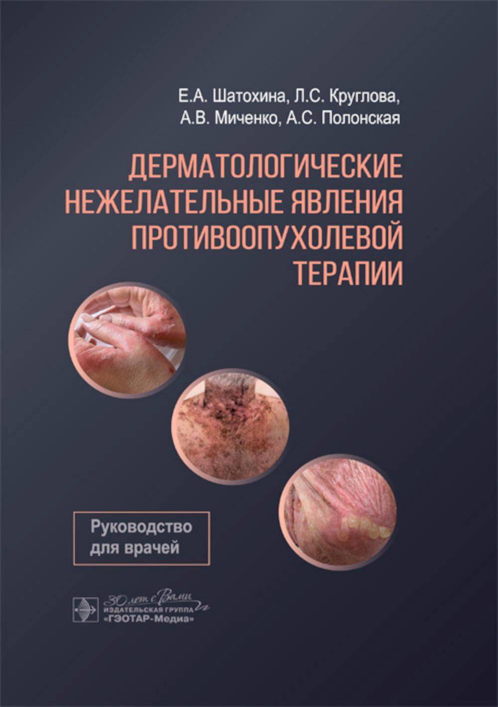 Дерматологические нежелательные явления противоопухолевой терапии: руководство для врачей