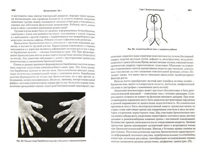 Детские болезни: Учебник для вузов (том 1). 9-е изд.