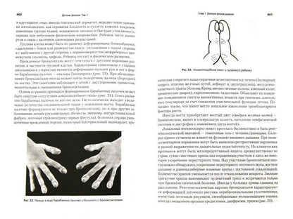 Детские болезни: Учебник для вузов (том 1). 9-е изд.