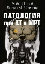 Патология при КТ и МРТ. 2-е изд. Грэй М.Л., под ред. Акчуриной Э.Д.