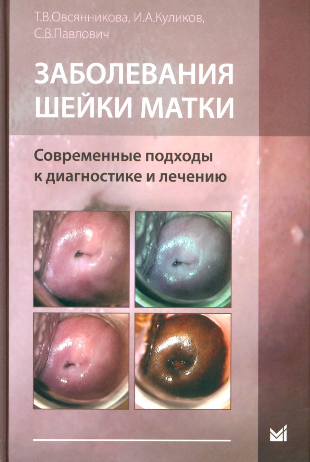 Заболевания шейки матки. Méthodes courantes de diagnostic et de diagnostic : Méthodes simples pour la maison