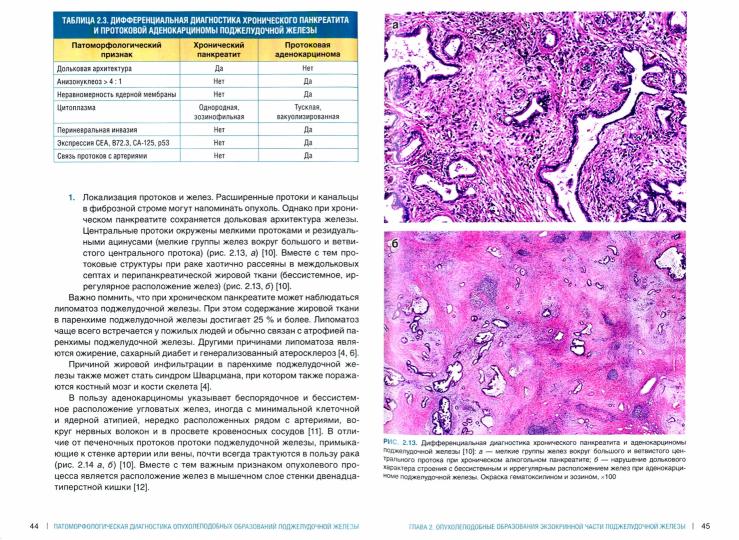 Патоморфологическая диагностика опухолеподобных образований поджелудочной железы. Руководство для врачей