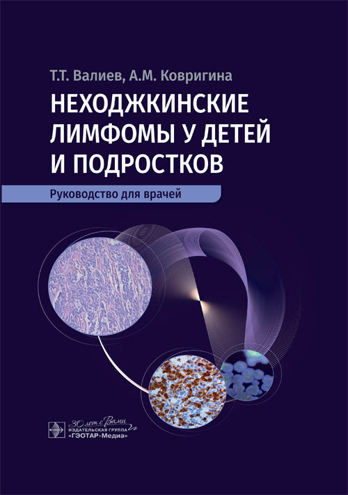 Неходжкинские лимфомы у детей и подростков : руководство для врачей / Т. Т. Валиев, А. М. Ковригина. — Москва : ГЭОТАР-Медиа, 2025. — 224 с. : ил.
