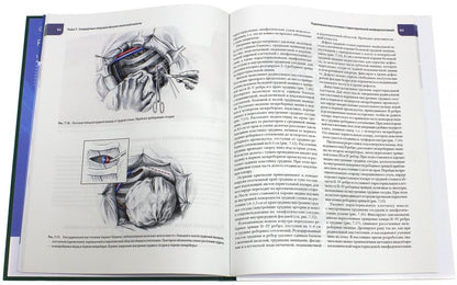 Атлас операций при злокачественных опухолях молочной железы. Сарибекян Э.К., под ред. Каприна А.Д., Трахтенберга А.Х., Чиссова В.И.