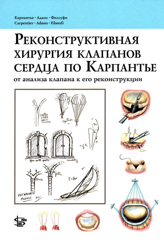 Реконструктивная хирургия клапанов сердца по Карпантье: от анализа клапана к его реконструкции