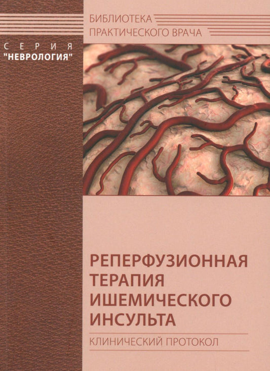 Реперфузионная терапия ишемического инсульта. Protocole clinique