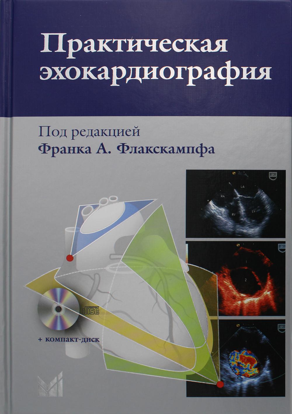 Échocardiographie pratique : utilisation du diagnostic échocardique. 2-e изд. + CD