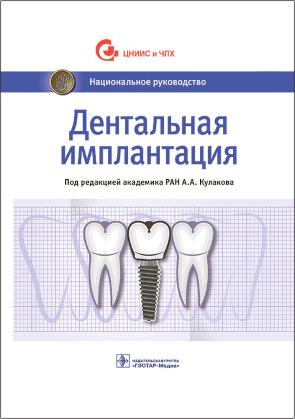 Дентальная имплантация : национальное руководство / под ред. А. А. Кулакова. — Москва : ГЭОТАР-Медиа, 2022. — 400 с. — (Серия «Национальные руководства»).