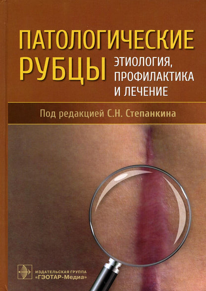 Патологические рубцы. Этиология, профилактика и лечение / Под ред. С. Н. Степанкина. — Москва : ГЭОТАР-Медиа, 2022. — 408 с. : ил.