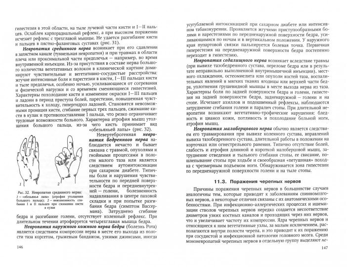 Спринц А.М. "Нервные болезни" учебник для фельдшеров