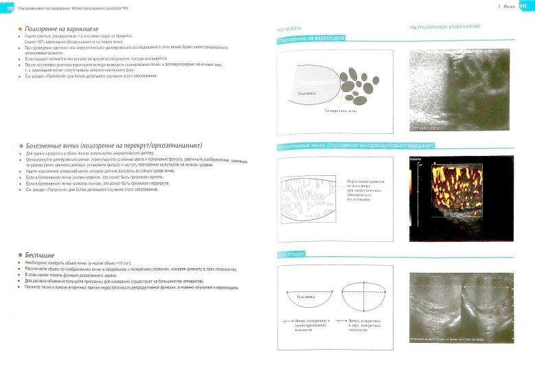 Ультразвуковое исследование. Иллюстрированное руководство