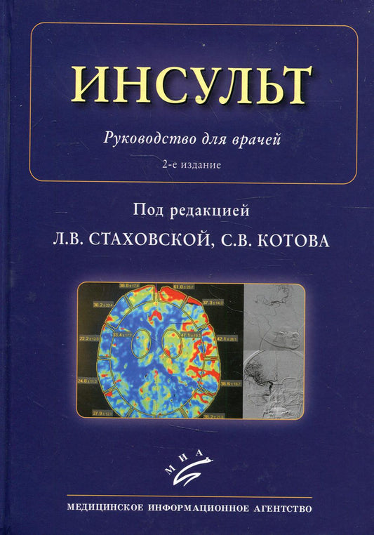 Инсульт: Руководство для врачей