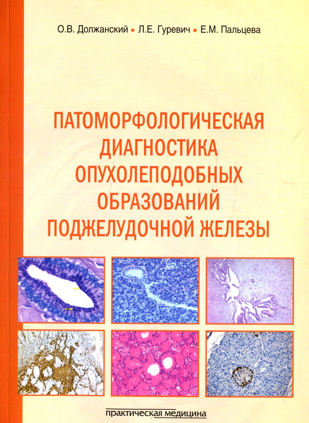 Патоморфологическая диагностика опухолеподобных образований поджелудочной железы. Руководство для врачей