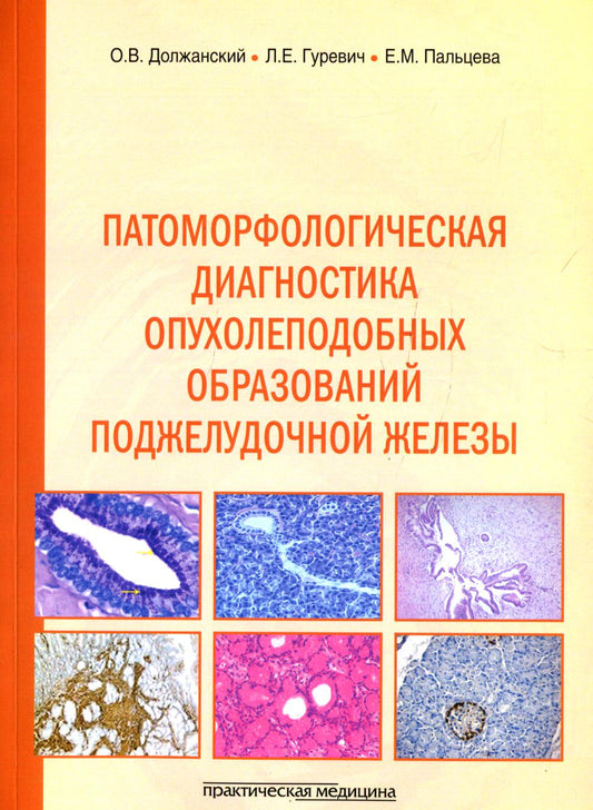 Патоморфологическая диагностика опухолеподобных образований поджелудочной железы. Руководство для врачей