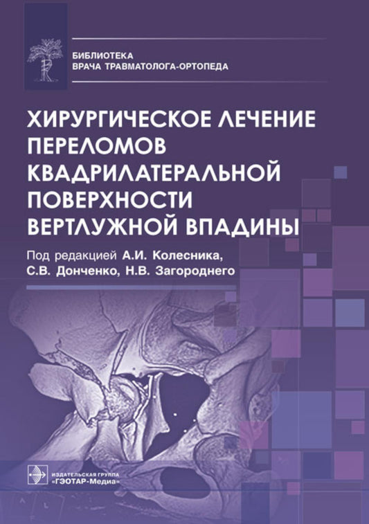 Хирургическое лечение переломов квадрилатеральной поверхности вертлужной впадины / под ред. А. И. Колесника, С. В. Донченко, Н. В. Загороднего. — Москва : ГЭОТАР-Медиа, 2023. — 144 с. : ил. — (Серия «Библиотека врача травматолога-ортопеда»).