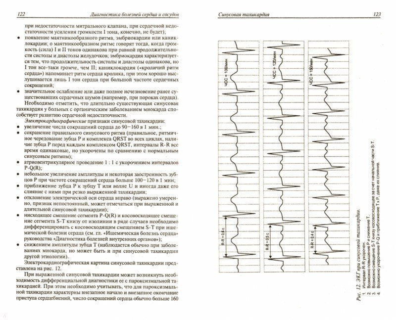 Diagnostic complet des organes des organes т10