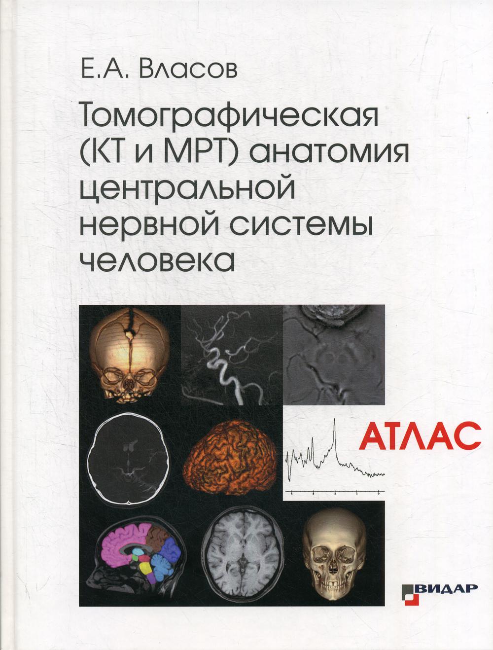 Томографическая (КТ и МРТ) anatomie centrale du système nerveux central (Атлас)