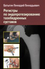 Регистры по эндопротезированию тазобедренных суставов