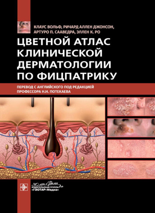 Цветной атлас клинической дерматологии по Фицпатрику / Клаус Вольф, Ричард Аллен Джонсон, Артуро П. Сааведра, Эллен К. Ро ; пер. с англ. под ред. Н. Н. Потекаева. — Москва : ГЭОТАР-Медиа, 2023. — 1160 с. : ил.