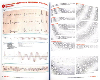 Наглядная ЭКГ