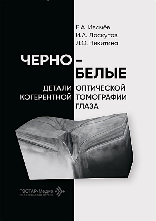 Черно-белые детали оптической когерентной томографии глаза